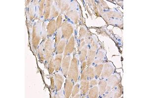 Immunohistochemistry of paraffin-embedded mouse skeletal muscle using MYH4 antibody (ABIN7268749) at dilution of 1:150 (40x lens). (MYH4 抗体  (AA 1450-1550))