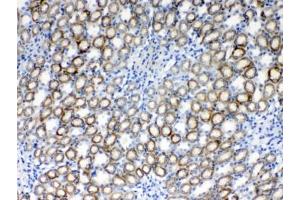 IHC testing of FFPE rat kidney tissue with RPS6 antibody at 1ug/ml. (RPS6 抗体  (AA 13-52))