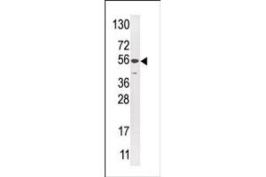 Image no. 1 for anti-Ubiquitin Specific Peptidase 16 (USP16) (N-Term) antibody (ABIN357550) (USP16 抗体  (N-Term))