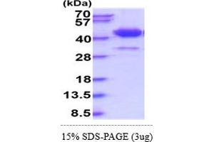 SFTPD Protein (AA 22-375) (His tag)