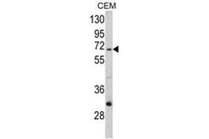 Western blot analysis of ND5 Antibody (C-term) in CEM cell line lysates (35ug/lane). (MT-ND5 抗体  (C-Term))