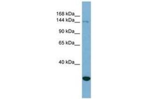 Image no. 1 for anti-Jumonji, AT Rich Interactive Domain 2 (JARID2) (AA 215-264) antibody (ABIN6741955) (JARID2 抗体  (AA 215-264))