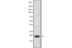 Western blot analysis of TXN2 using HepG2 whole cell lysates (TXN2 抗体  (Internal Region))