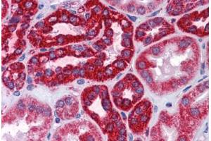 Human Kidney: Formalin-Fixed, Paraffin-Embedded (FFPE) (COX6B1 抗体  (AA 1-87))