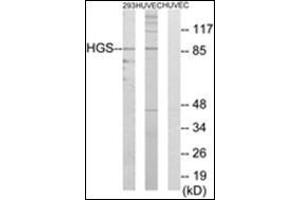 Western blot analysis of extracts from 293/HuvEc cells, using HGS Antibody. (HGS 抗体  (Internal Region))