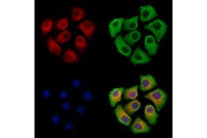 ABIN7094862 and ABIN7098913 staining Hela cells by IF/ICC. (HAS2 抗体  (C-Term))