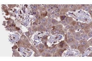 Immunohistochemistry (IHC) image for anti-Protein Kinase, CAMP-Dependent, Regulatory, Type I, alpha (Tissue Specific Extinguisher 1) (PRKAR1A) (N-Term) antibody (ABIN6264423)