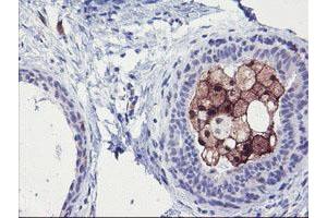 Immunohistochemical staining of paraffin-embedded Human breast tissue using anti-SDS mouse monoclonal antibody. (serine Dehydratase 抗体)