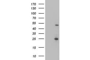 Western Blotting (WB) image for anti-Myocyte Enhancer Factor 2C (MEF2C) antibody (ABIN1499363) (MEF2C 抗体)