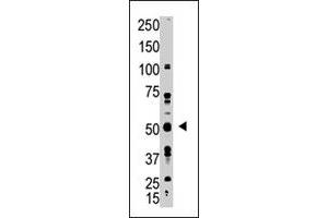 The GDF10 polyclonal antibody  is used in Western blot to detect GDF10 in A-375 cell lysate. (GDF10 抗体  (N-Term))