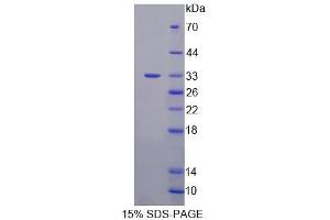 SDS-PAGE analysis of Mouse ZFHX1B Protein.