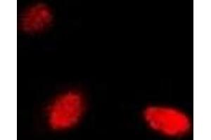 Immunofluorescent analysis of NUDT2 staining in Hela cells. (NUDT2 抗体)