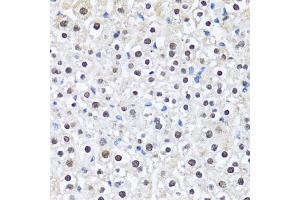 Immunohistochemistry of paraffin-embedded mouse liver using CCAR2 antibody. (CCAR2 抗体)