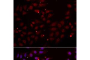 Immunofluorescence analysis of HeLa cells using CST2 Polyclonal Antibody (CST2 抗体)