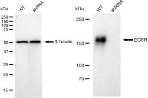 Western blotting analysis using EGFR antibody (ABIN7798462). (Recombinant EGFR 抗体)