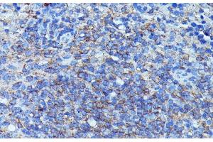 Immunohistochemistry of paraffin-embedded Mouse spleen using CSF3 Polyclonal Antibody at dilution of 1:100 (40x lens). (G-CSF 抗体)