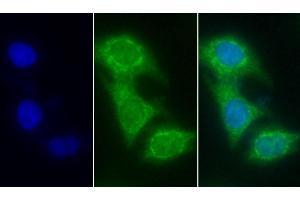 Detection of CYCS in Human Hela cell using Monoclonal Antibody to Cytochrome C (CYCS)