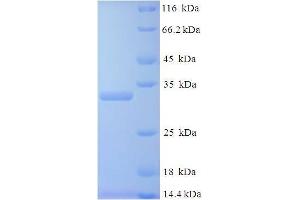 SDS-PAGE (SDS) image for Placenta Growth Factor (PGF) (AA 19-170) protein (His-SUMO Tag) (ABIN5710083)