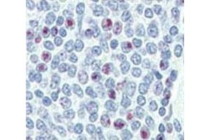 Immunohistochemistry (IHC) image for anti-Nanog Homeobox (NANOG) (AA 15-49) antibody (ABIN3031942)