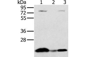 Western Blot analysis of Raji cell and Human liver cancer tissue, hela cell using NDUFAF2 Polyclonal Antibody at dilution of 1:250 (NDUFAF2 抗体)