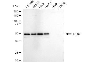 Western blotting analysis using CD116 antibody (ABIN7798133).