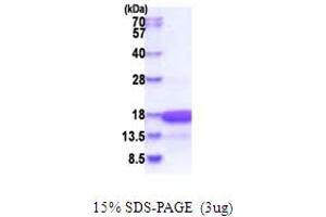 SDS-PAGE (SDS) image for High Mobility Group Nucleosomal Binding Domain 3 (HMGN3) (AA 1-77) protein (His tag) (ABIN5853856)