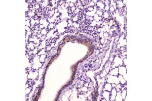 IHC testing of FFPE mouse lung tissue with Leptin antibody at 2ug/ml. (Leptin 抗体  (AA 22-167))
