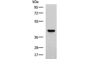 Western blot analysis of Ramos cell lysate using FCRLA Polyclonal Antibody at dilution of 1:750 (FCRLA 抗体)