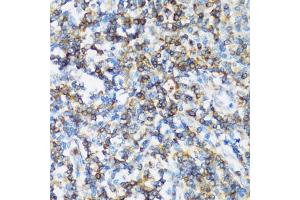 Immunohistochemistry of paraffin-embedded human tonsil using  antibody (ABIN1678742, ABIN3018765, ABIN3018766 and ABIN5664716) at dilution of 1:100 (40x lens). (ARHGEF1 抗体  (AA 783-912))