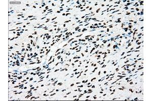 Immunohistochemical staining of paraffin-embedded Kidney tissue using anti-TYRO3mouse monoclonal antibody. (TYRO3 抗体)