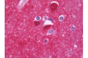 Anti-PPP3CB antibody IHC staining of human brain, cortex. (PPP3CB 抗体  (AA 63-393))