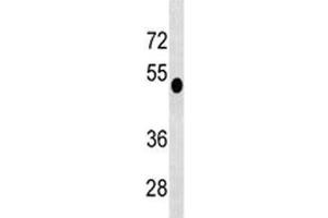 Western Blotting (WB) image for anti-Dual Specificity Phosphatase 6 (DUSP6) (AA 59-88) antibody (ABIN3030776)