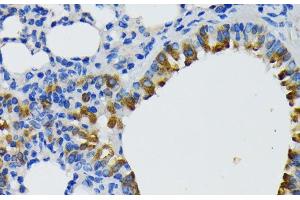 Immunohistochemistry (Paraffin-embedded Sections) (IHC (p)) image for anti-IQ Motif Containing GTPase Activating Protein 1 (IQGAP1) antibody (ABIN7261628)