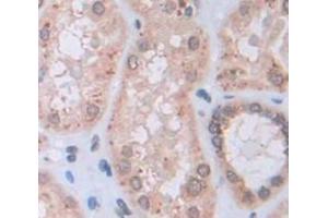 IHC-P analysis of Human Tissue, with DAB staining. (IDS 抗体  (AA 95-289))