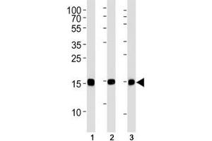 SUMO-2 antibody western blot analysis in (1) CEM, (2) 293, (3) rat C6 lysate. (SUMO2 抗体)