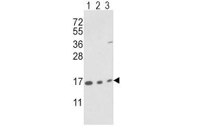 Western Blotting (WB) image for anti-Peptidylprolyl Isomerase A (Cyclophilin A) (PPIA) antibody (ABIN3001732) (PPIA 抗体)