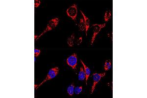 Confocal immunofluorescence analysis of HeLa cells using  antibody (ABIN3023384, ABIN3023385, ABIN3023386 and ABIN1678613) at dilution of 1:200.