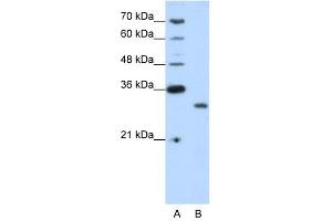 CPXCR1 antibody (20R-1231) used at 0. (CPXCR1 抗体  (N-Term))