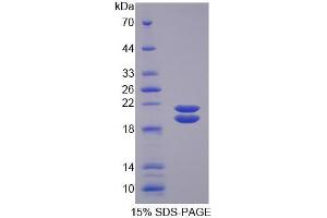 SDS-PAGE analysis of Mouse SPD Protein. (SFTPD 蛋白)