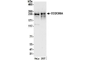 anti-Coiled-Coil Domain Containing 88A (CCDC88A) (AA 1425-1475) antibody