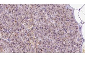 ABIN6273297 at 1/100 staining Human pancreas cancer tissue by IHC-P. (PIK3IP1 抗体  (N-Term))