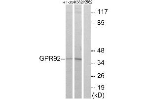 Western blot analysis of extracts from HT-29 cells and K562 cells, using GPR92 antibody. (LPAR5 抗体  (Internal Region))