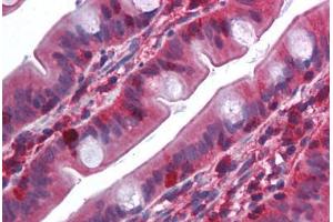 Human Small Intestine (formalin-fixed, paraffin-embedded) stained with TRAF2 antibody ABIN214009 at 5 ug/ml followed by biotinylated goat anti-rabbit IgG secondary antibody ABIN481713, alkaline phosphatase-streptavidin and chromogen. (TRAF2 抗体  (N-Term))