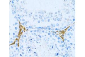Immunohistochemistry of paraffin-embedded Mouse testis leydig using KLHL42 Polyclonal Antibody at dilution of 1:100 (40x lens). (KLHDC5 抗体)