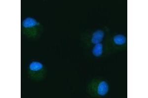 IF analysis of TOMM40 using anti-TOMM40 antibody (ABIN7599738).