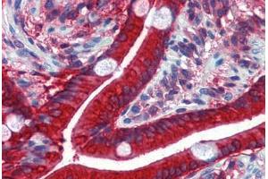 Human Small Intestine: Formalin-Fixed, Paraffin-Embedded (FFPE) (CES2 抗体  (AA 514-622))