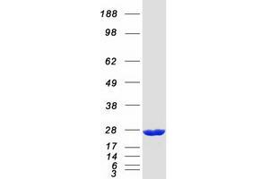 Western Blotting (WB) image for ADP-Ribosylation Factor-Like 8A (ARL8A) protein (Myc-DYKDDDDK Tag) (ABIN2714917)