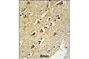 Immunohistochemistry (Paraffin-embedded Sections) (IHC (p)) image for anti-Ribosomal Protein L18a (RPL18A) (AA 140-166), (C-Term) antibody (ABIN653086)