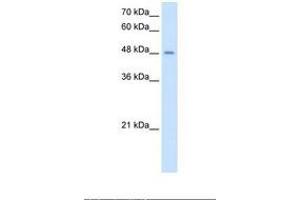 Image no. 1 for anti-Transmembrane Protease, serine 11D (TMPRSS11D) (AA 51-100) antibody (ABIN321109) (TMPRSS11D 抗体  (AA 51-100))