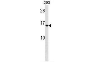 C9orf46 Antibody (C-term) western blot analysis in 293 cell line lysates (35µg/lane). (C9ORF72 抗体  (C-Term))